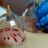 حجامت و بادکش میدان هفت حوض
