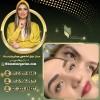 ترمیم میکروبلیدینگ ابرو با غزل زرگریان