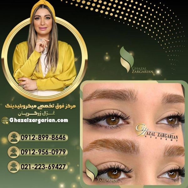 میکروبلیدینگ غزل زرگریان با بروزترین تکنیکها