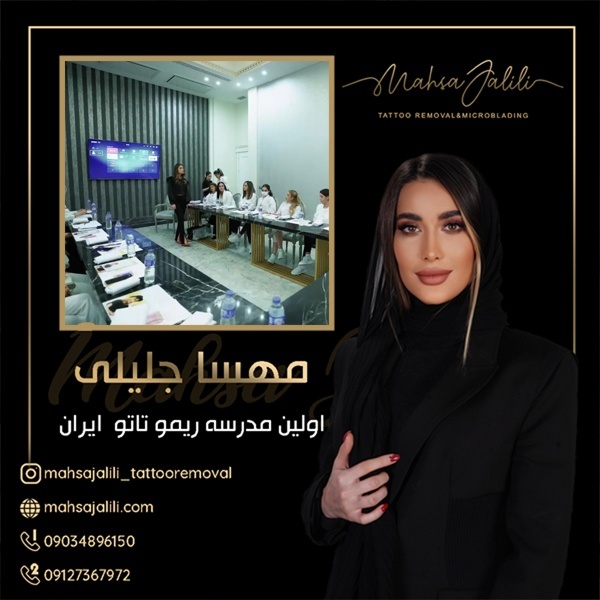 ریمو تاتو بدون درد در تهران