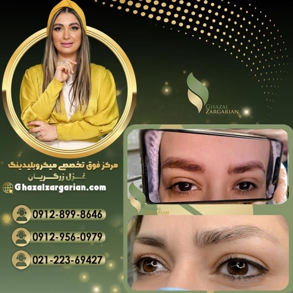 پاک کردن تاتو ابرو با ریموور توسط غزل زرگریان
