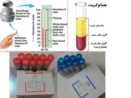 فروش انواع لوله های موئین خونگیری هماتوکریت