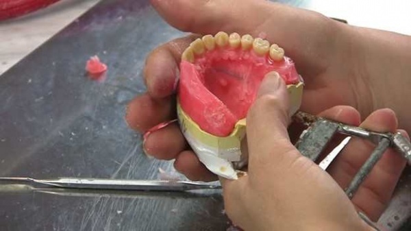 دست دندان با بیمه