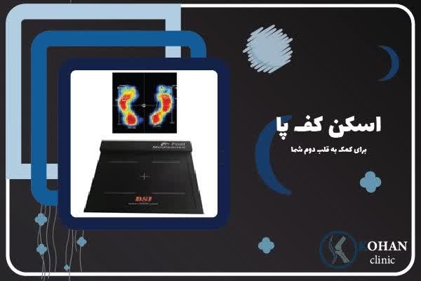 اسکن کف پا و کفی طبی غرب تهران – کلینیک تخصصی سلام