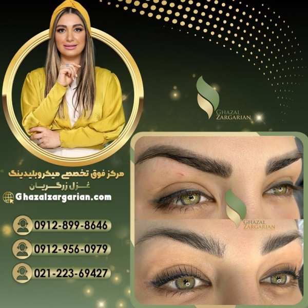 ریموو تاتو ابرو توسط غزل زرگریان