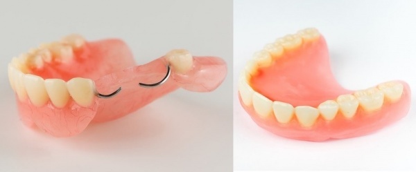 دندانسازی رایگان