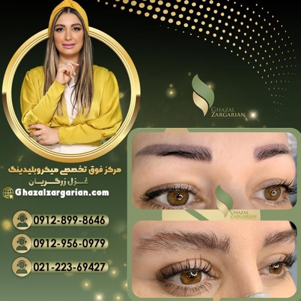 پاک کردن تاتو با مواد در مرکز غزل زرگریان
